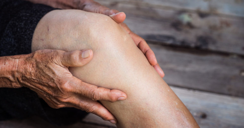 What Are Some Natural Remedies For Osteoarthritis