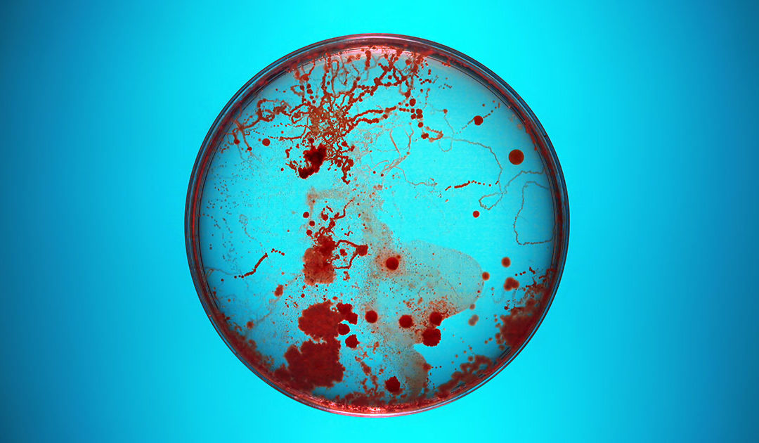 Protect Yourself from the Next Superbug, Part 2